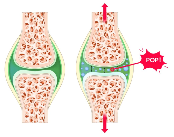 Diagram of synovial joint space