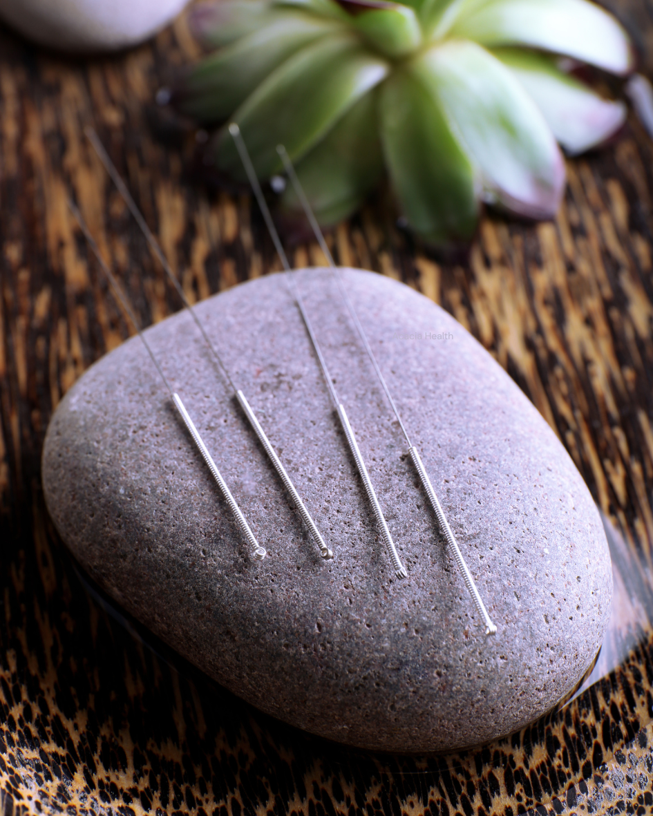acupuncture needles on display