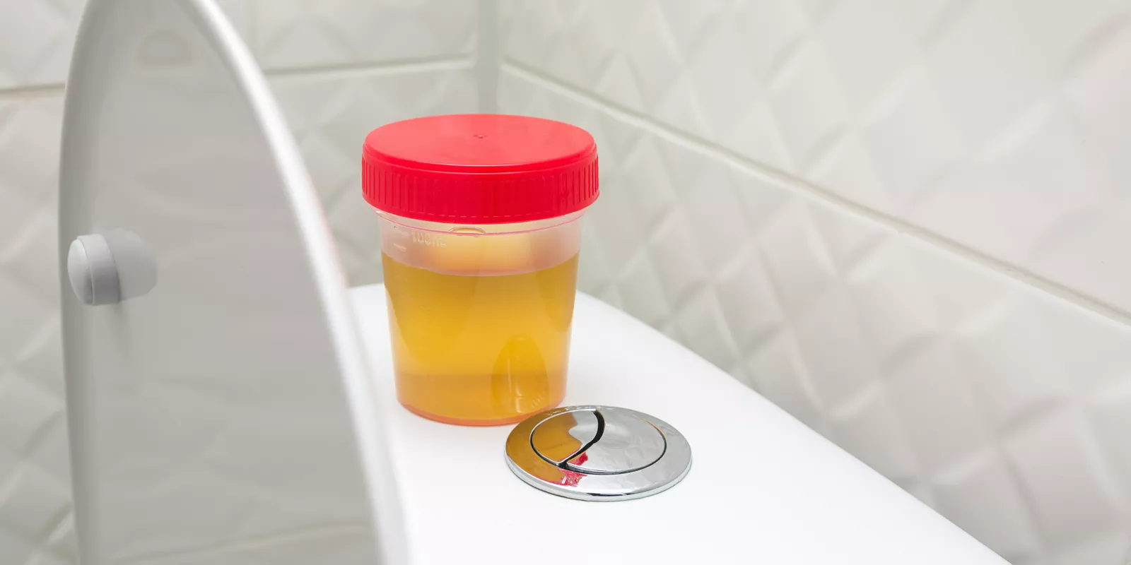 Urine sample container resting on a toilet tank