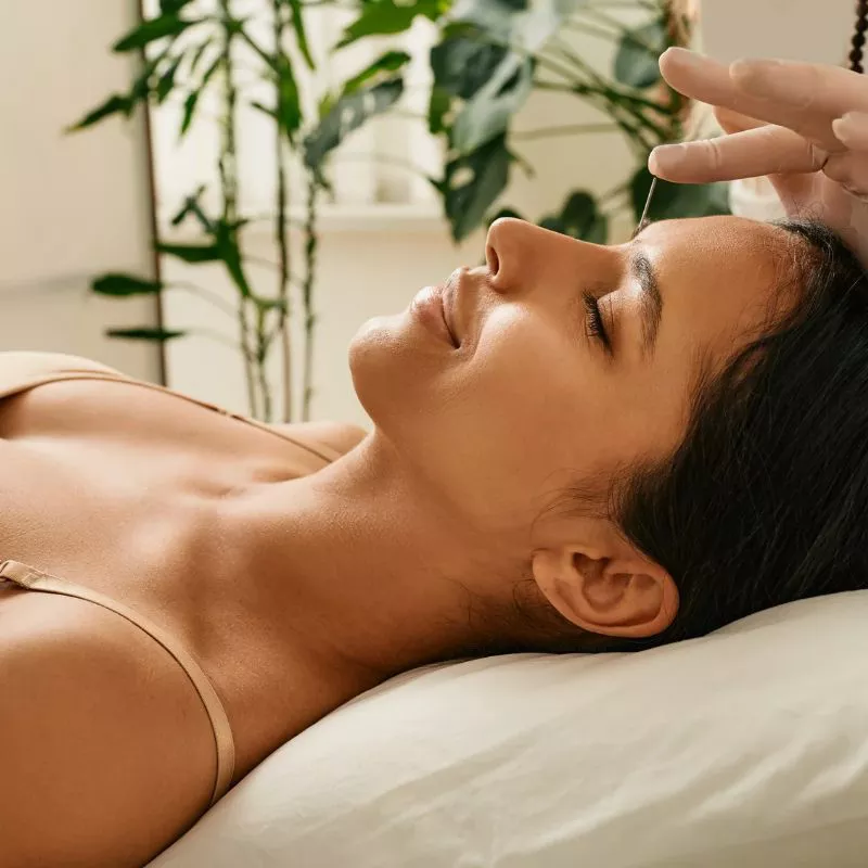Relaxed woman getting acupuncture