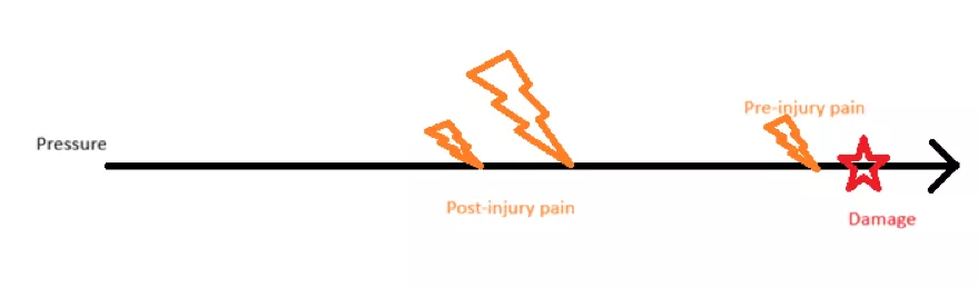 Diagram of pain sensitization